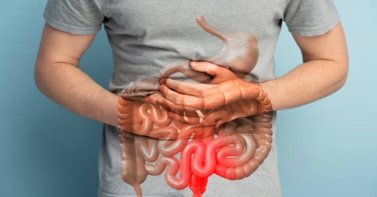 Gasteointestinal.jpg